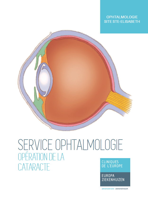 cataracte